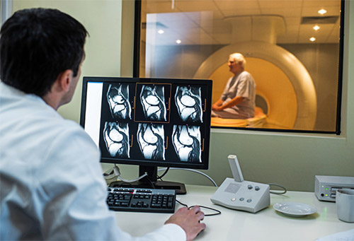 Radiologist examining MRI scans.